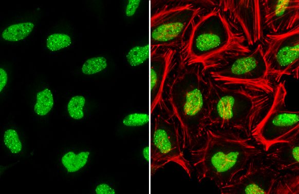ATRX Rabbit Polyclonal Antibody
