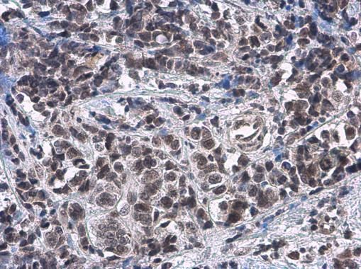 ATRX Rabbit Polyclonal Antibody