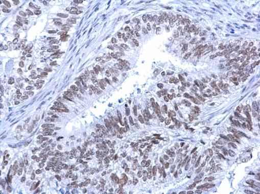 ATRX Rabbit Polyclonal Antibody