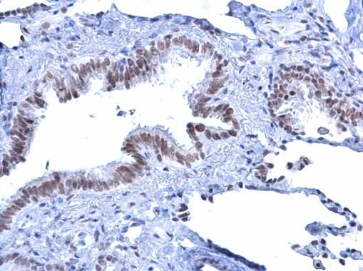 ATRX Rabbit Polyclonal Antibody