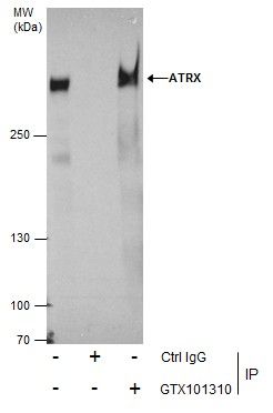 ATRX Rabbit Polyclonal Antibody