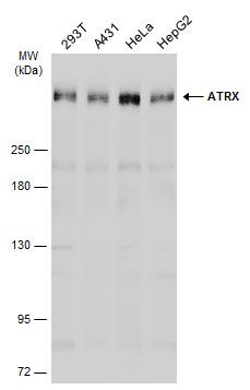 ATRX Rabbit Polyclonal Antibody