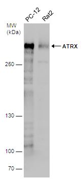 ATRX Rabbit Polyclonal Antibody