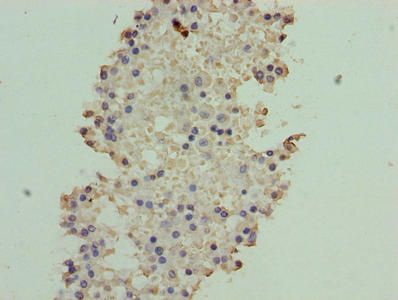 ATXN7L1 Antibody