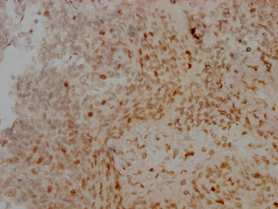 AURKB Antibody