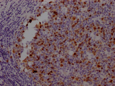AURKB Antibody