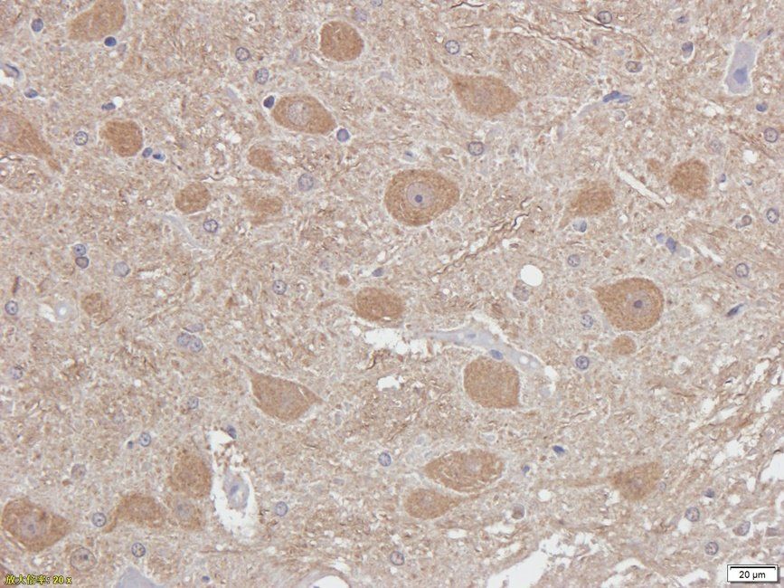 Autotaxin Rabbit Polyclonal Antibody