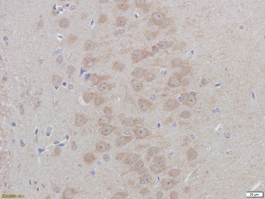 Autotaxin Rabbit Polyclonal Antibody