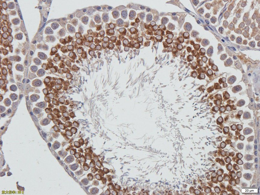 Autotaxin Rabbit Polyclonal Antibody