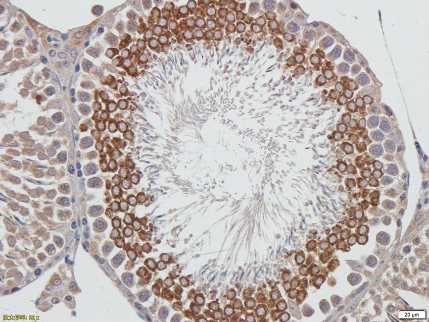 Autotaxin Rabbit Polyclonal Antibody