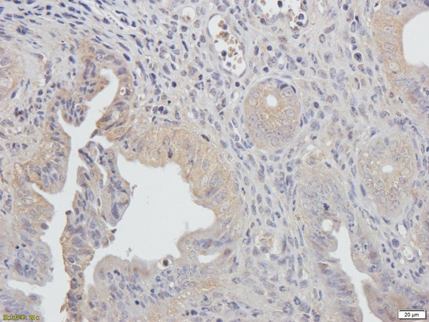 Autotaxin Rabbit Polyclonal Antibody