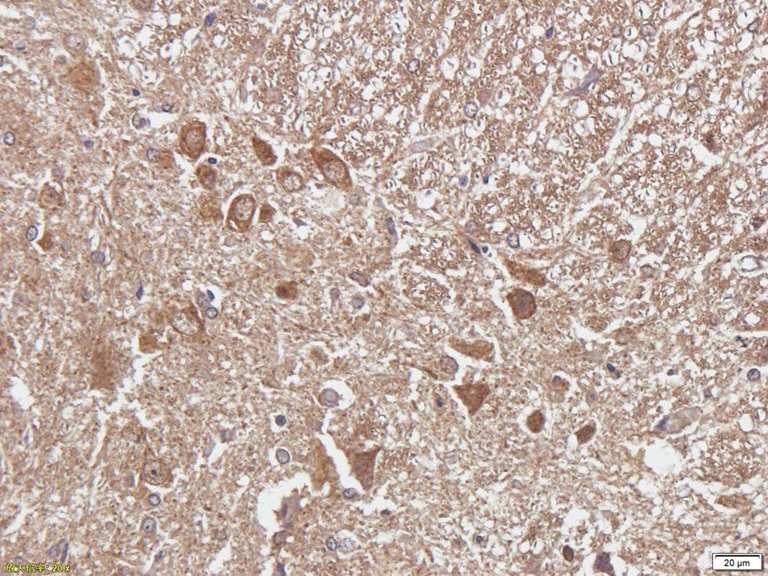 Autotaxin Rabbit Polyclonal Antibody