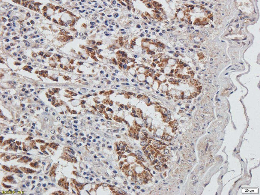 Autotaxin Rabbit Polyclonal Antibody