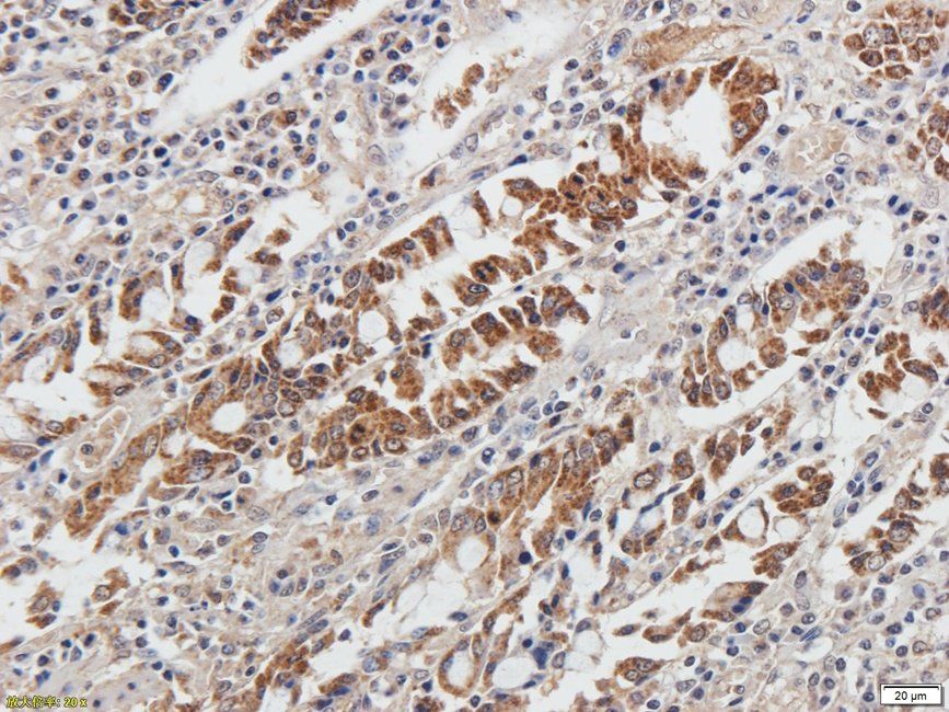 Autotaxin Rabbit Polyclonal Antibody