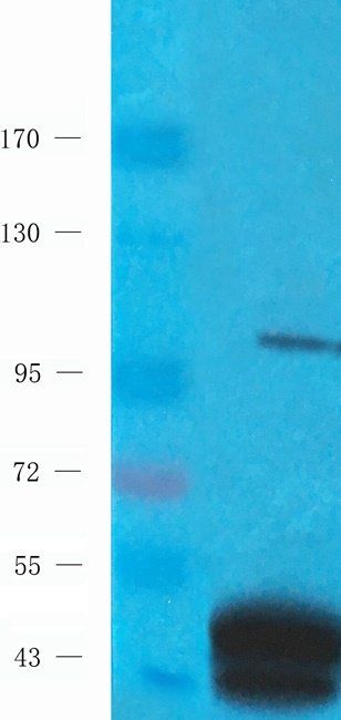 Autotaxin Rabbit Polyclonal Antibody
