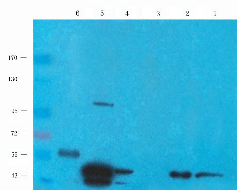 Autotaxin Rabbit Polyclonal Antibody