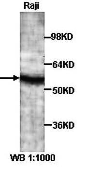 AVEN Rabbit Polyclonal Antibody