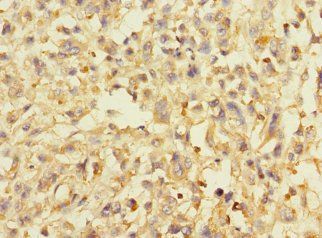 AVPI1 Antibody