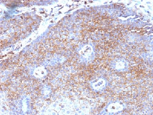 B2M Antibody