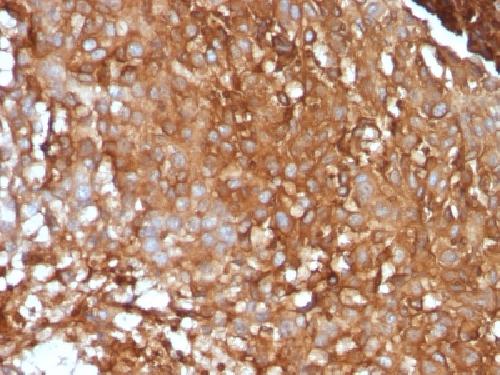 B2M Antibody