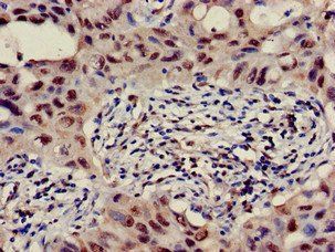 B3GALT4 Antibody