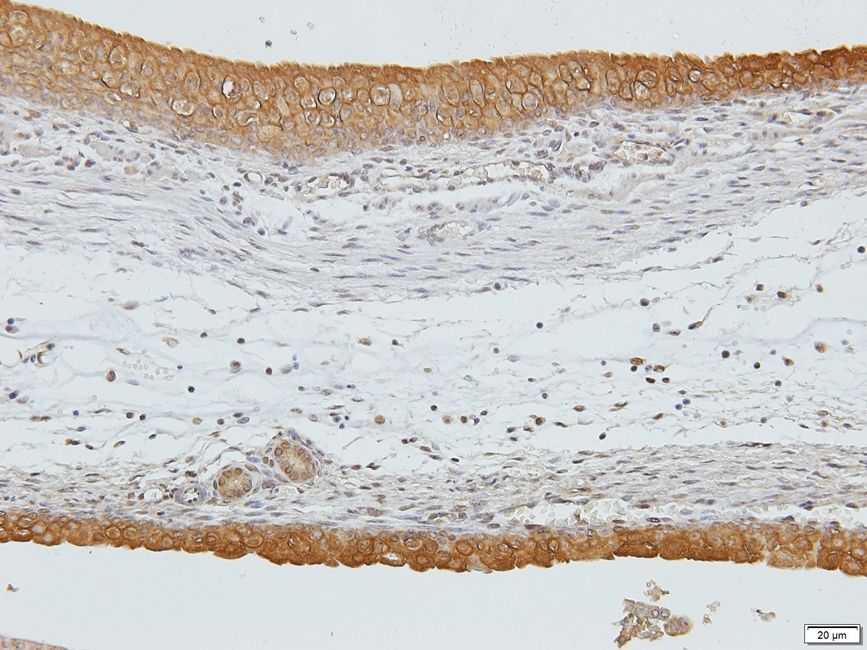 B4GALNT4 Rabbit Polyclonal Antibody