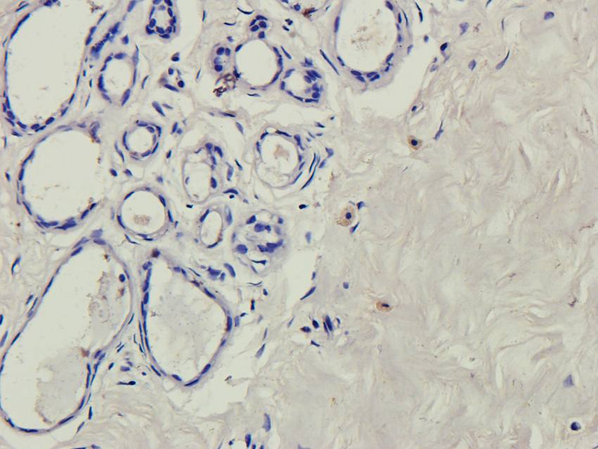 B7-H6 Rabbit Polyclonal Antibody
