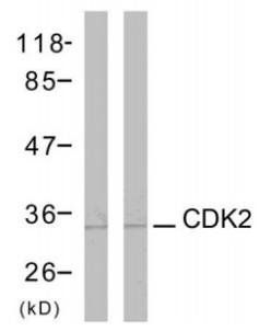 CDC2 (Ab-161) Antibody