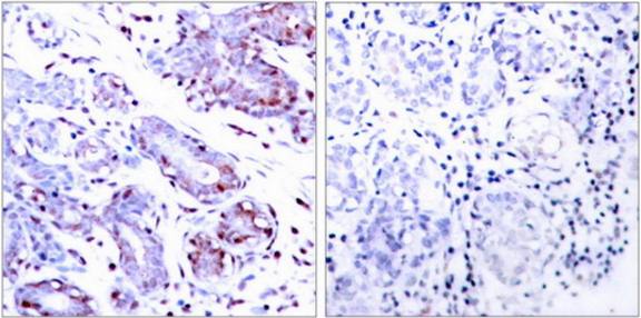 STAT1 (Ab-701) Antibody