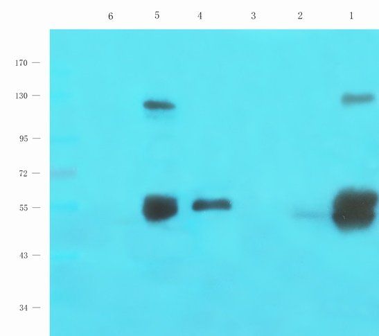 BAIAP2 Rabbit Polyclonal Antibody