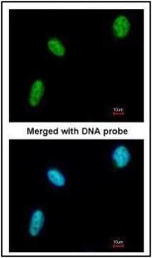 BAT1 Rabbit Polyclonal Antibody