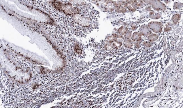 BAT1 Rabbit Polyclonal Antibody
