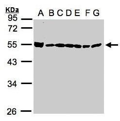 BAT1 Rabbit Polyclonal Antibody