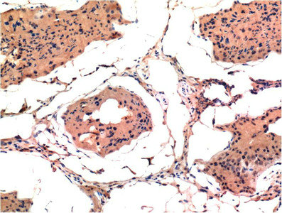 BAX Antibody