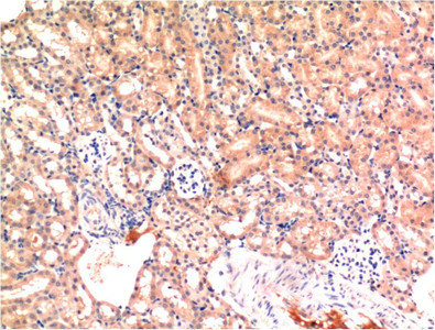 BAX Antibody