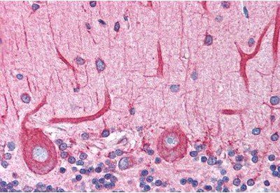 BCAP31/BAP31 Antibody