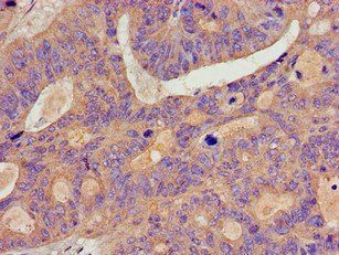 BCAR1 Antibody