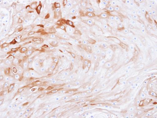 BCAT2 Rabbit Polyclonal Antibody