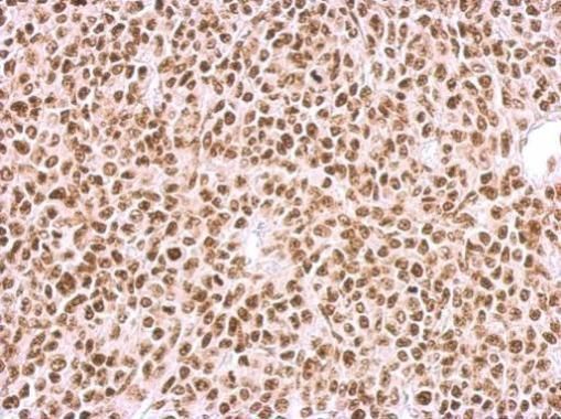 BCCIP Rabbit Polyclonal Antibody