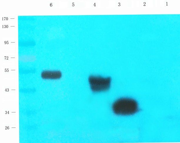 BCKDHA Rabbit Polyclonal Antibody