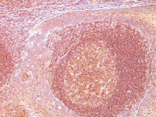BCL10 Antibody