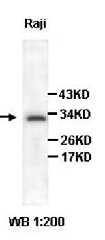 BCL10 Rabbit Polyclonal Antibody