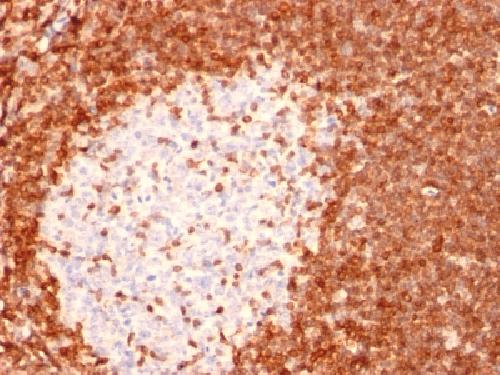 BCL2 Antibody