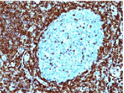 BCL2 Antibody