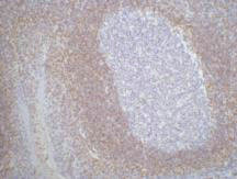 BCL2 Antibody