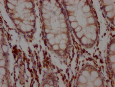 BCL2 Antibody