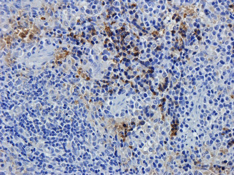 BCL2 Rabbit Polyclonal Antibody