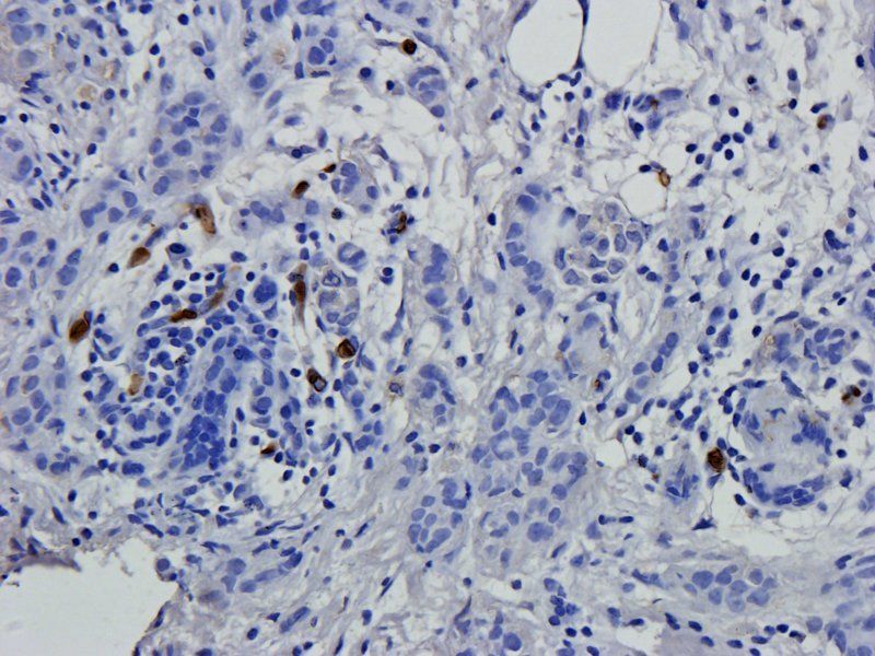 BCL2 Rabbit Polyclonal Antibody