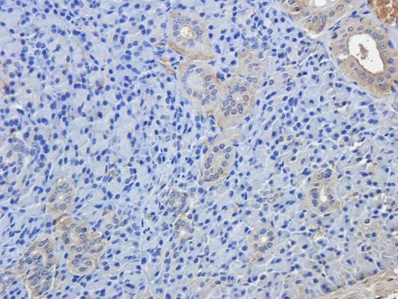BCL2 Rabbit Polyclonal Antibody