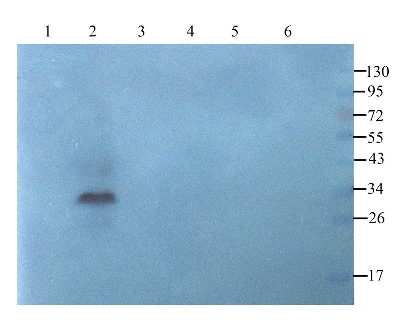 BCL2 Rabbit Polyclonal Antibody
